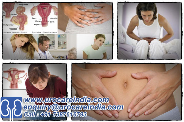 India is one stop destination for low cost fibroid surgery1